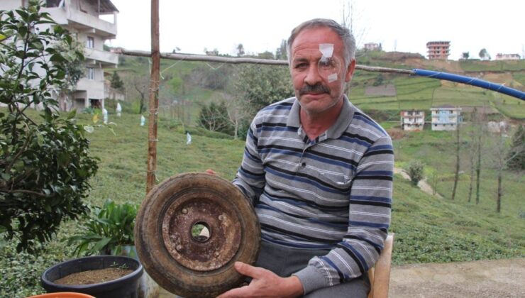 Hava bastığı lastik bomba gibi patladı, bir gözünü kaybetti